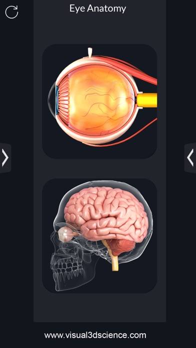 My Eye Anatomy screenshot #2
