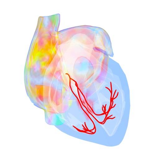 Atrial Fibrillation