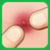 Pimple Popper app icon