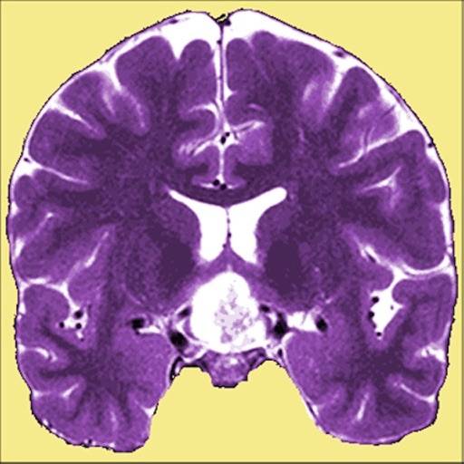 delete Neuro Toolkit