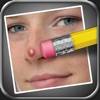 Pimple Eraser app icon