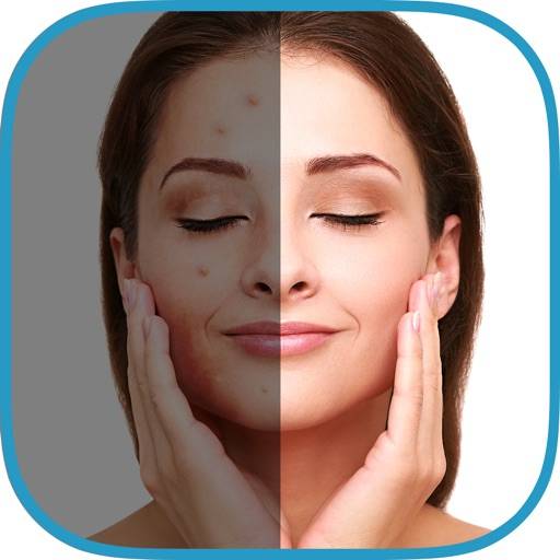 eliminar Cool Pimple Eraser plus