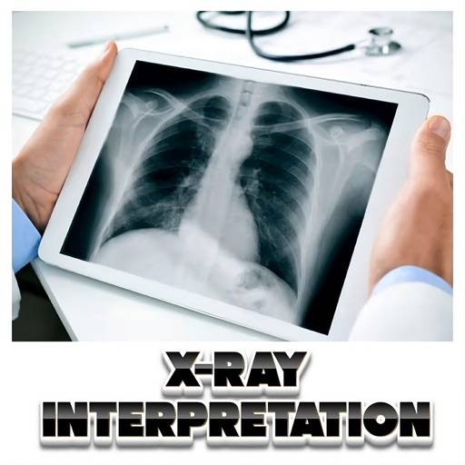 X-Ray Interpretation Guide