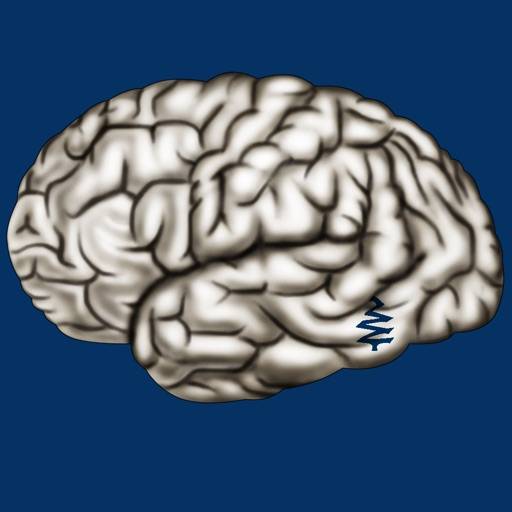 eliminar Cerebrum ID
