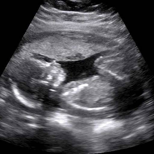 Baby Ultrasound 2015 icon